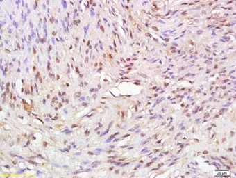 Anti-ATAD2 antibody used in IHC (Paraffin sections) (IHC-P). GTX52041