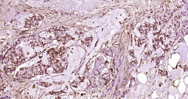 Anti-ATAD2 antibody used in IHC (Paraffin sections) (IHC-P). GTX52041