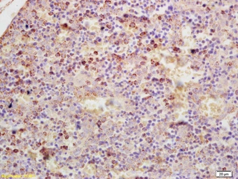 Anti-GDPD3 antibody used in IHC (Paraffin sections) (IHC-P). GTX52060