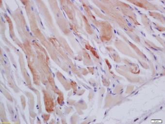 Anti-HSPB7 antibody used in IHC (Paraffin sections) (IHC-P). GTX52159