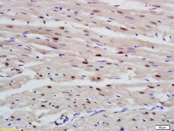 Anti-RBM20 antibody used in IHC (Paraffin sections) (IHC-P). GTX52196