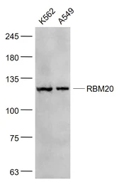 Anti-RBM20 antibody used in Western Blot (WB). GTX52196