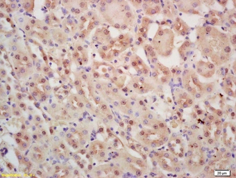 Anti-INTS3 antibody used in IHC (Paraffin sections) (IHC-P). GTX52238