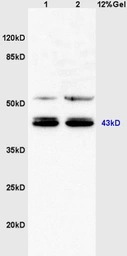 Anti-C3orf21 antibody used in Western Blot (WB). GTX52264