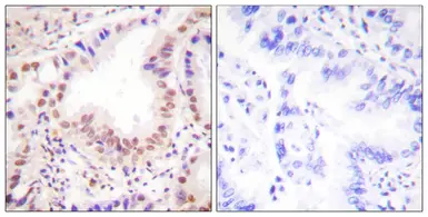 Anti-ETS1 antibody used in IHC (Paraffin sections) (IHC-P). GTX52308