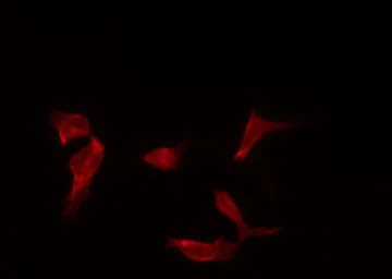 Anti-IKK alpha (phospho Ser180) + IKK beta (phospho Ser181) antibody used in Immunocytochemistry/ Immunofluorescence (ICC/IF). GTX52309