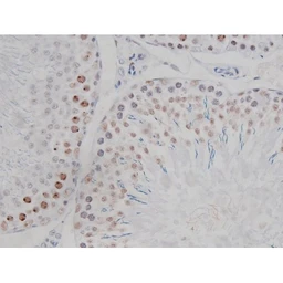 Anti-IKK alpha (phospho Ser180) + IKK beta (phospho Ser181) antibody used in IHC (Paraffin sections) (IHC-P). GTX52309