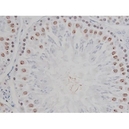 Anti-IKK alpha (phospho Ser180) + IKK beta (phospho Ser181) antibody used in IHC (Paraffin sections) (IHC-P). GTX52309
