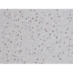 Anti-IKK alpha (phospho Ser180) + IKK beta (phospho Ser181) antibody used in IHC (Paraffin sections) (IHC-P). GTX52309