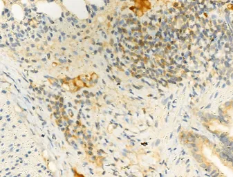 Anti-IKK alpha (phospho Ser180) + IKK beta (phospho Ser181) antibody used in IHC (Paraffin sections) (IHC-P). GTX52309