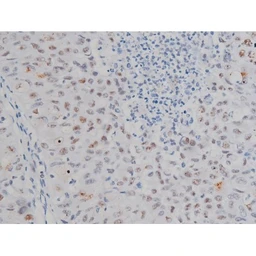 Anti-IKK alpha (phospho Ser180) + IKK beta (phospho Ser181) antibody used in IHC (Paraffin sections) (IHC-P). GTX52309