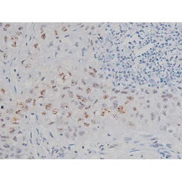 Anti-IKK alpha (phospho Ser180) + IKK beta (phospho Ser181) antibody used in IHC (Paraffin sections) (IHC-P). GTX52309