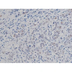 Anti-IKK alpha (phospho Ser180) + IKK beta (phospho Ser181) antibody used in IHC (Paraffin sections) (IHC-P). GTX52309