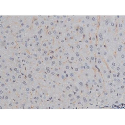 Anti-IKK alpha (phospho Ser180) + IKK beta (phospho Ser181) antibody used in IHC (Paraffin sections) (IHC-P). GTX52309