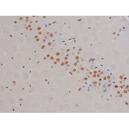 Anti-IKK alpha (phospho Ser180) + IKK beta (phospho Ser181) antibody used in IHC (Paraffin sections) (IHC-P). GTX52309