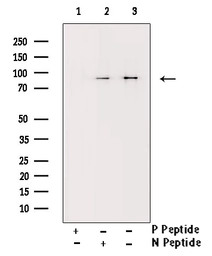 Anti-IKK alpha (phospho Ser180) + IKK beta (phospho Ser181) antibody used in Western Blot (WB). GTX52309