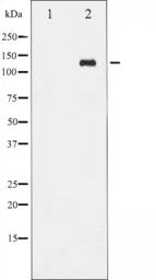 Anti-c-Abl (phospho Tyr412) antibody used in Western Blot (WB). GTX52312