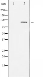 Anti-PKC alpha (phospho Thr497) antibody used in Western Blot (WB). GTX52316