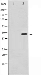 Anti-Synaptotagmin 1 (phospho Ser312) + Synaptotagmin 2 (phospho Ser309) antibody used in Western Blot (WB). GTX52317