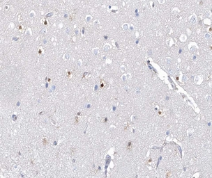 Anti-AHR (phospho Ser36) antibody used in IHC (Paraffin sections) (IHC-P). GTX52324