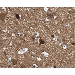 Anti-JNK (phospho Thr183/Tyr185) antibody used in IHC (Paraffin sections) (IHC-P). GTX52326