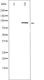 Anti-STAT5B (phospho Ser731) antibody used in Western Blot (WB). GTX52330