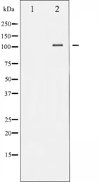 Anti-NFAT4 (phospho Ser165) antibody used in Western Blot (WB). GTX52339