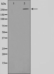 Anti-Acetyl-CoA Carboxylase 1 (phospho Ser80) antibody used in Western Blot (WB). GTX52340