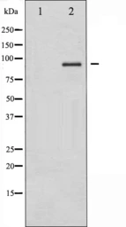 Anti-IKK alpha + IKK beta antibody used in Western Blot (WB). GTX52347