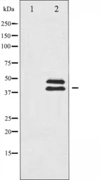 Anti-ERK1/2 antibody used in Western Blot (WB). GTX52355