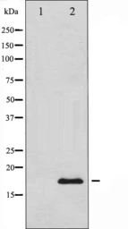 Anti-Calmodulin antibody used in Western Blot (WB). GTX52363