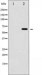 Anti-SMAD2 / SMAD3 antibody used in Western Blot (WB). GTX52368