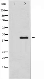 Anti-MEK1 + MEK2 antibody used in Western Blot (WB). GTX52370