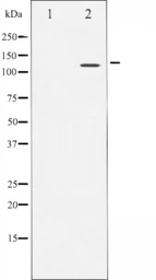 Anti-NFAT4 antibody used in Western Blot (WB). GTX52371