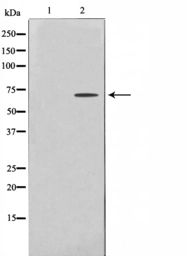 Anti-AMPK alpha 1 + AMPK alpha 2 antibody used in Western Blot (WB). GTX52373