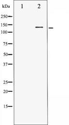 Anti-HDAC5 antibody used in Western Blot (WB). GTX52376