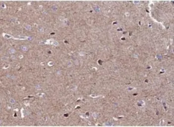 Anti-CaMK2 alpha/delta antibody used in IHC (Paraffin sections) (IHC-P). GTX52377
