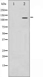 Anti-HDAC9 antibody used in Western Blot (WB). GTX52378