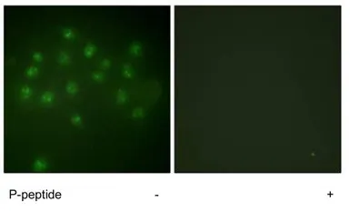 Anti-Vitamin D Receptor (phospho Ser208) antibody used in Immunocytochemistry/ Immunofluorescence (ICC/IF). GTX52380