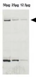 Anti-LRRK2 antibody used in Western Blot (WB). GTX52385