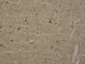 Anti-LRRK2 antibody used in IHC (Paraffin sections) (IHC-P). GTX52385