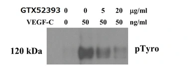 Anti-VEGFC antibody used in Neutralizing/Blocking/Inhibition (Neutralizing/Inhibition). GTX52393