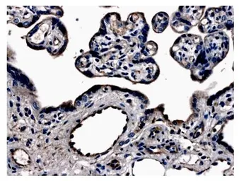 Anti-VEGF Receptor 3 antibody [7G63] used in IHC (Paraffin sections) (IHC-P). GTX52456