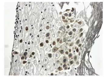 Anti-PDGF Receptor alpha antibody [8A89] used in IHC (Paraffin sections) (IHC-P). GTX52457