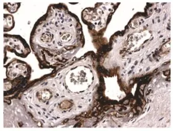Anti-PDGF Receptor beta antibody [5C37] used in IHC (Paraffin sections) (IHC-P). GTX52458