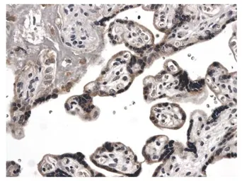 Anti-VEGFC antibody [2E65] used in IHC (Paraffin sections) (IHC-P). GTX52459