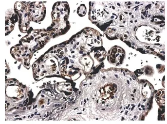 Anti-VEGF165 + VEGF121 antibody [2B86] used in IHC (Paraffin sections) (IHC-P). GTX52462