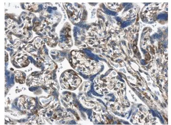 Anti-PDGFA antibody [6D35] used in IHC (Paraffin sections) (IHC-P). GTX52466