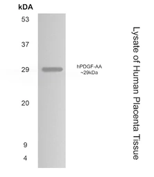 Anti-PDGFA antibody [6D35] used in Western Blot (WB). GTX52466