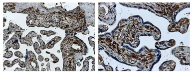 Anti-ACVRL1 antibody [8G33] used in IHC (Paraffin sections) (IHC-P). GTX52468